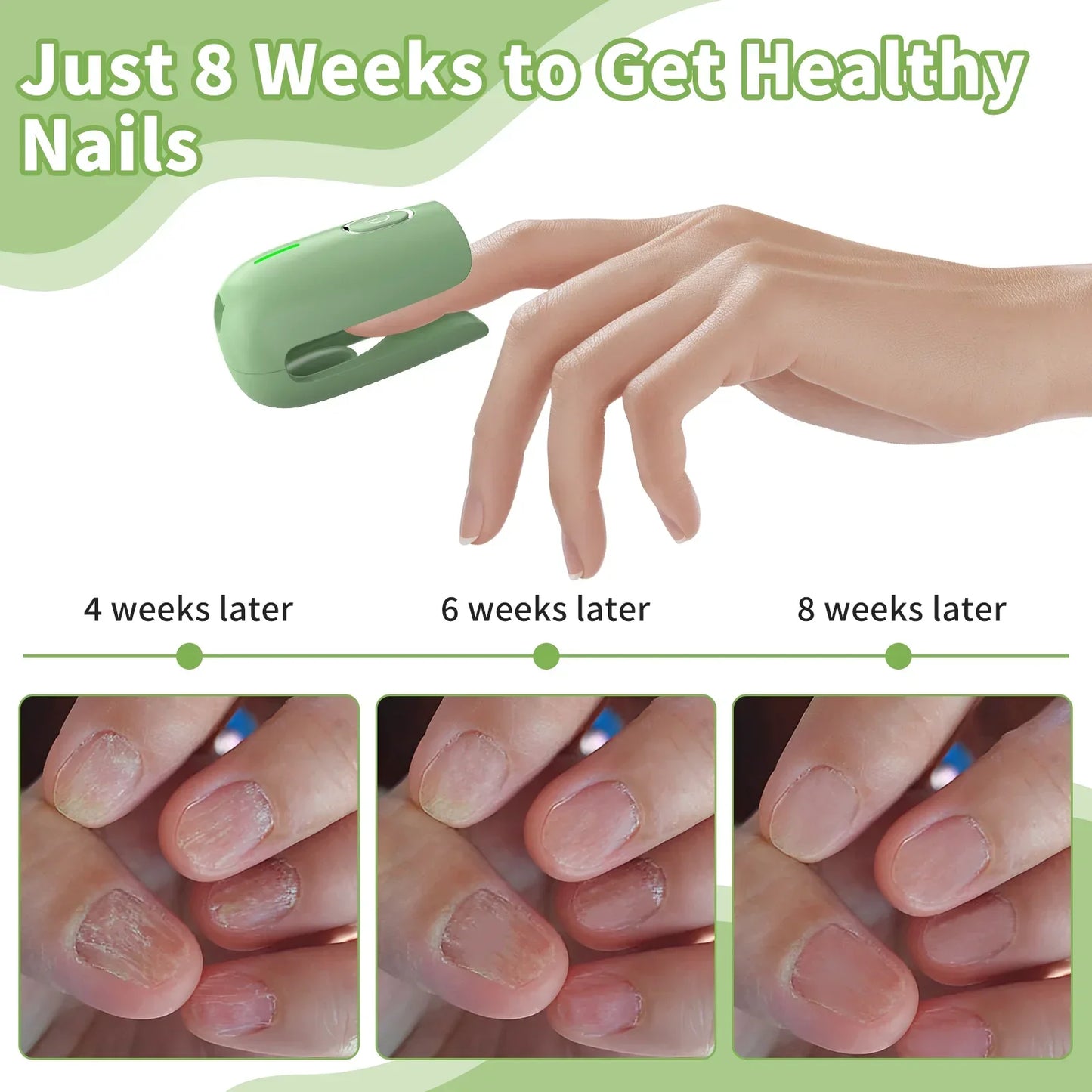 Nail Fungus Cleaning Device